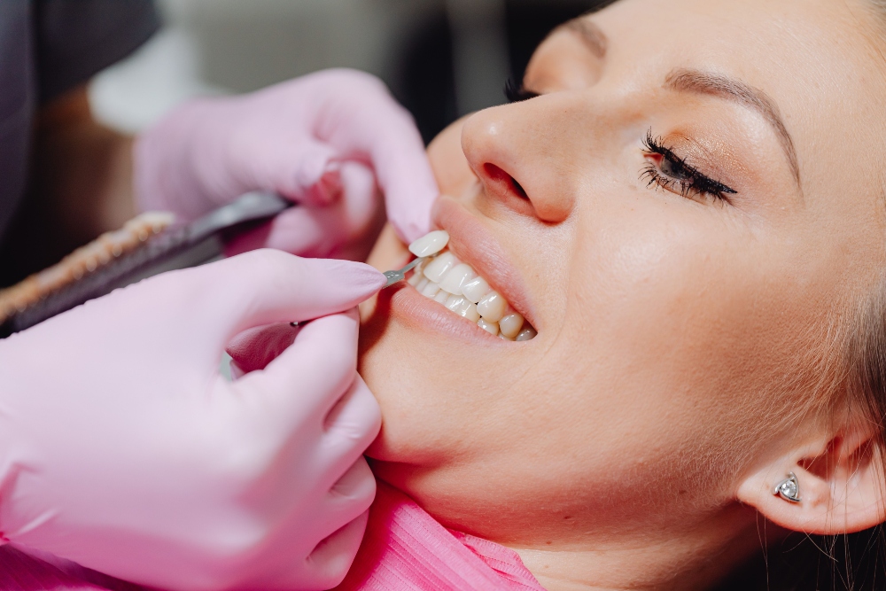 A woman having her teeth professionally whitened.